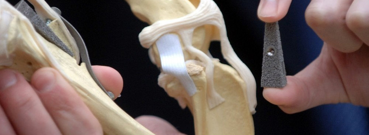 Huesos artificiales con impresoras 3D - ÓN